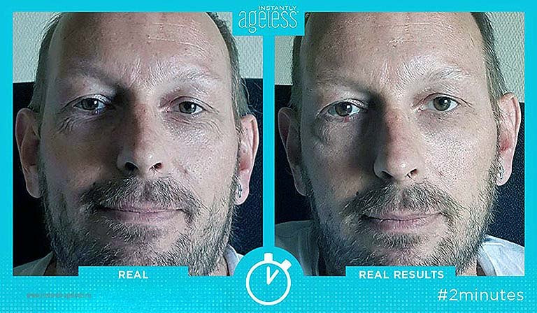 Подходит ли Instantly Ageless мужчинам?