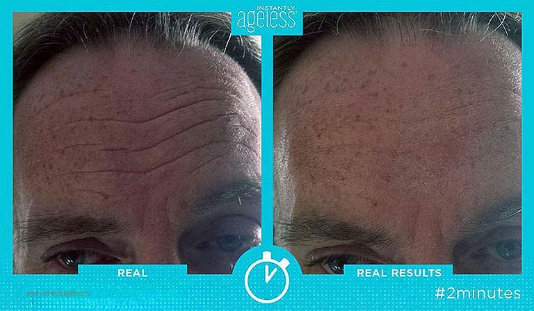 Мгновенно нестареющий крем полностью стер морщины на лбу.