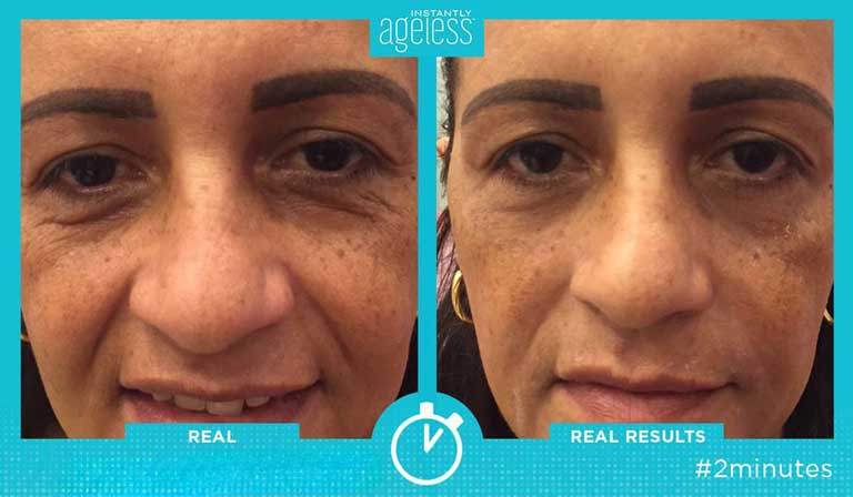 Мгновенно нестареющий крем вернул моим глазам молодость и красоту.