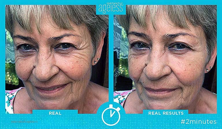 с Instantly ageless в 60 лет я обрел свое 40-летнее лицо