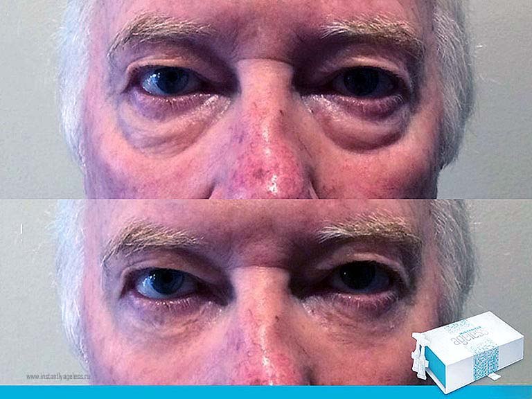 оригинальный продукт Instant Ageless есть только на Instantageless.ru