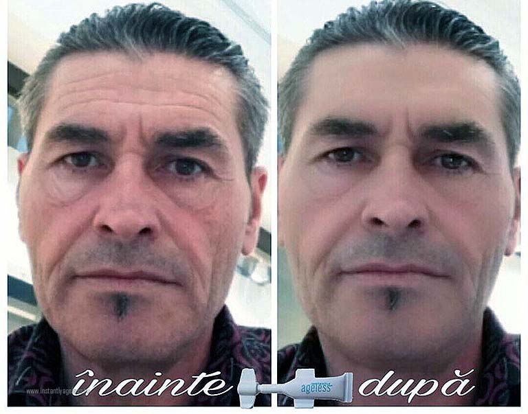 С Instantly Ageless я больше не старею