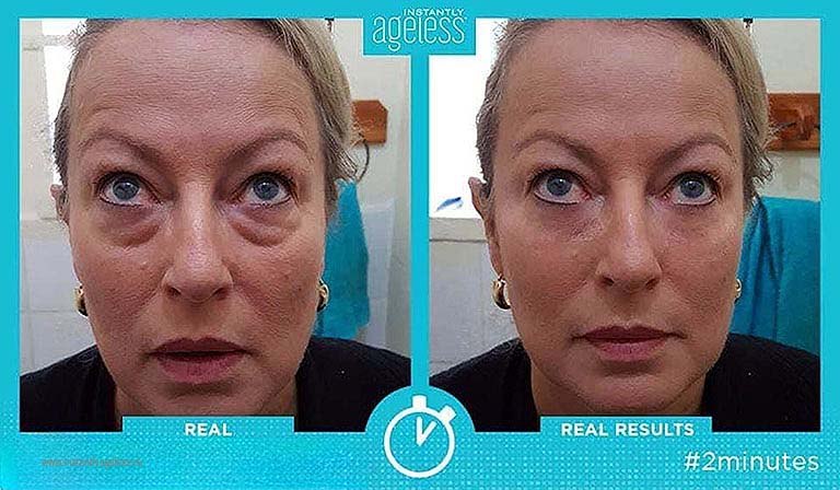 Хочу убрать мешки под глазами с помощью Instantly Ageless