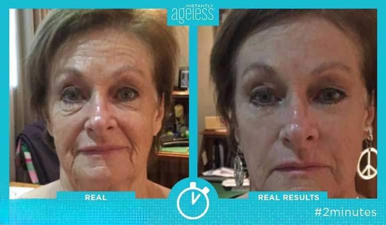 Мгновенно нестареющий крем подарил моему лицу улыбку и молодость.